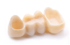 dental bangkok, dental cosmetic, dental clinic, dental crown, dental veneer, dentist bangkok, dental hospital, dental implants, invisalign bangkok, bangkok sukhumvit