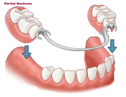 dental bangkok, dental cosmetic, dental clinic, dental crown, dental veneer, dentist bangkok, dental hospital, dental implants, invisalign bangkok, bangkok sukhumvit